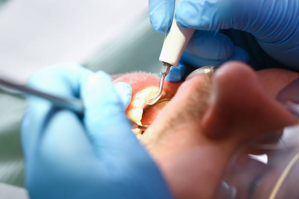 Best Broken Tooth Emergency  in Telford, TN